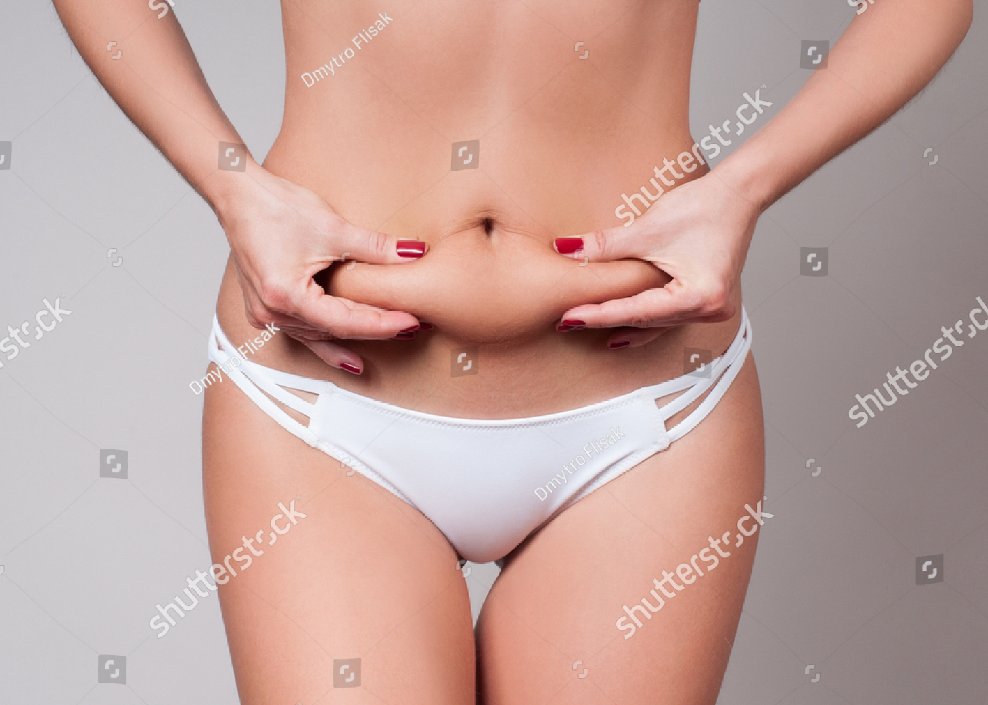 stock-photo-fat-female-belly-woman-holding-her-skin-for-cellulite-check-getting-rid-of-belly-fat-and-weight-773024251