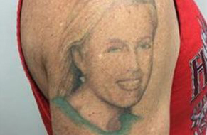 Laser-Tattoo-Removal-Oneonta-NY-Before-2