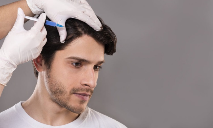 PRP for Hair Loss Oneonta